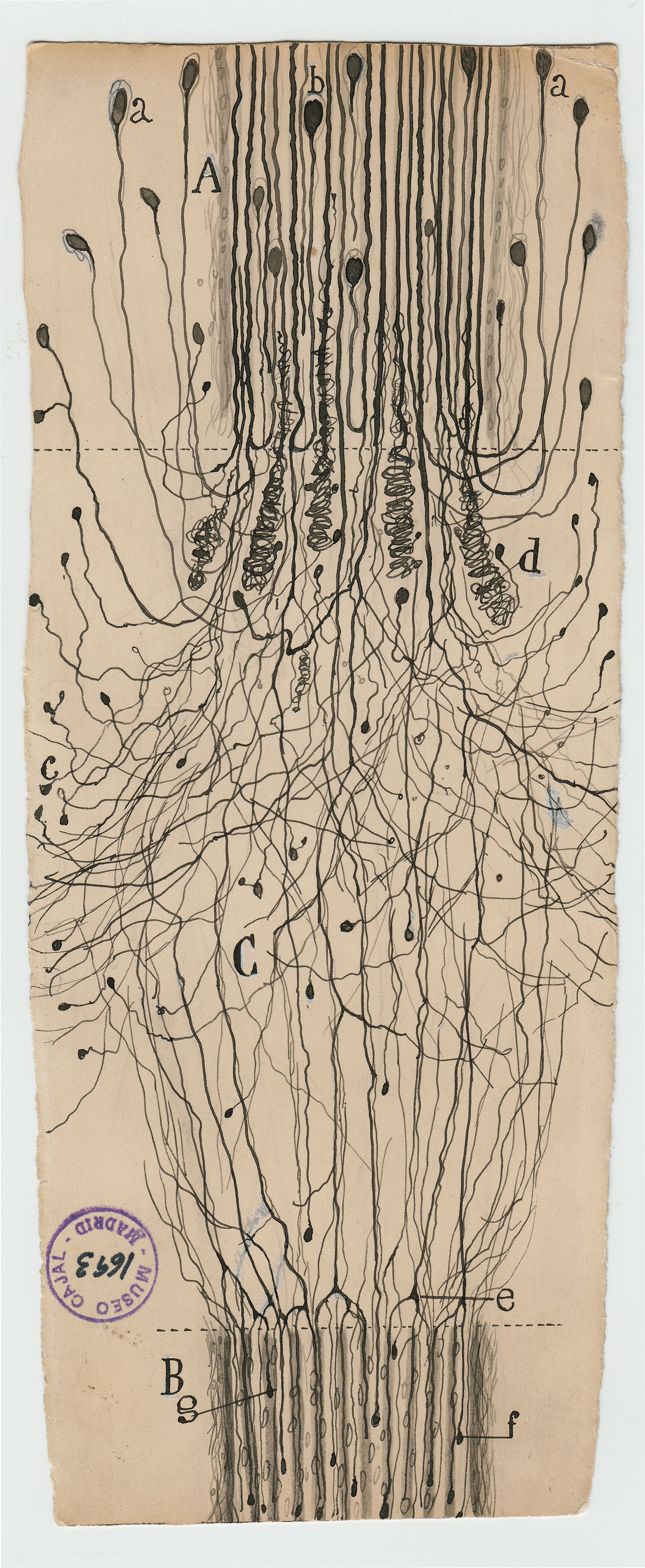 Santiago Ramón y Cajal's drawing of a severed nerve, 1913